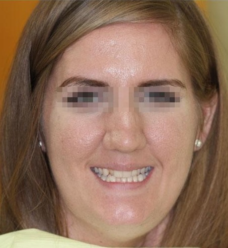 smile gallery image