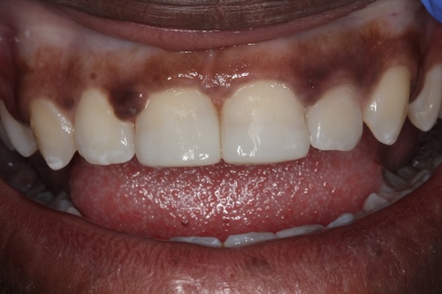 smile gallery image