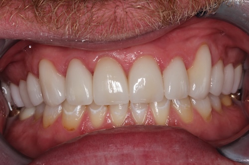 smile gallery image