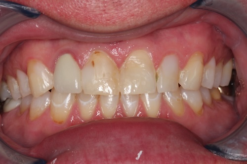 smile gallery image