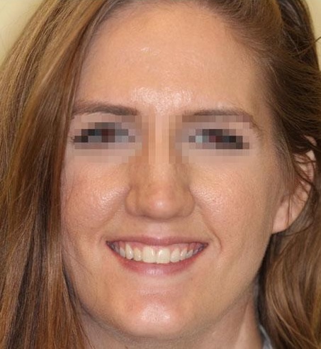 smile gallery image