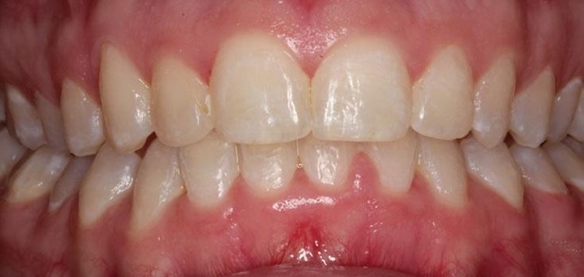 smile gallery image