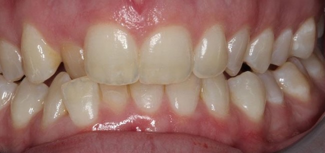 smile gallery image