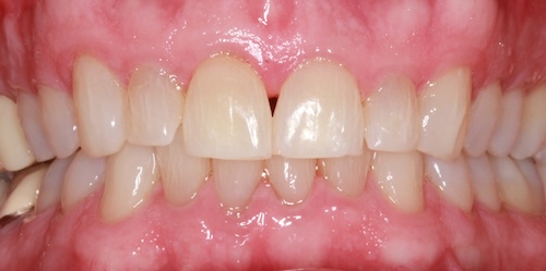 smile gallery image