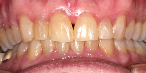 smile gallery image