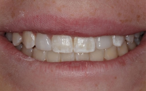 smile gallery image