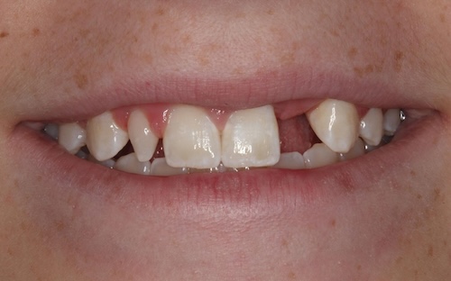 smile gallery image