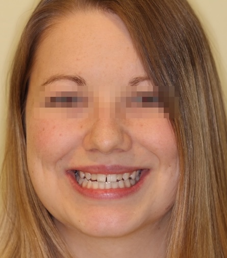 smile gallery image