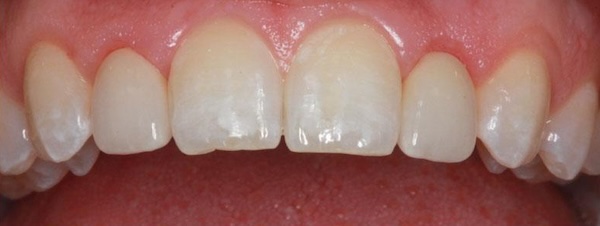 smile gallery image