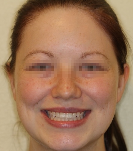 smile gallery image