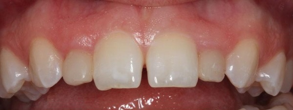 smile gallery image