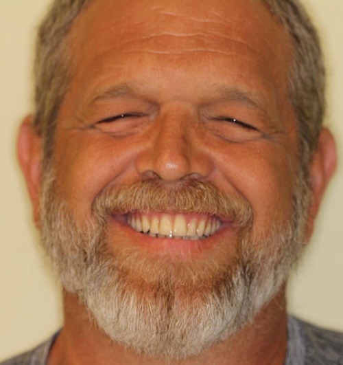 smile gallery image