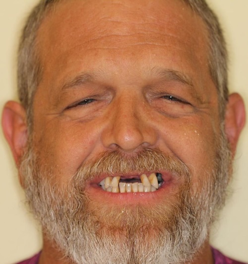 smile gallery image