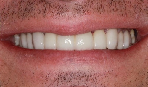 smile gallery image
