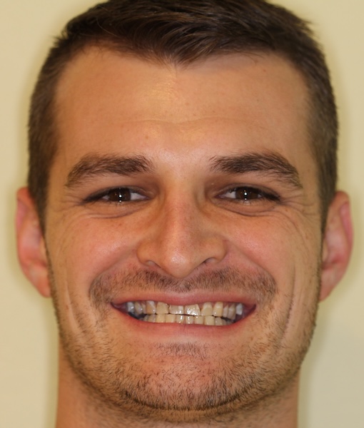 smile gallery image