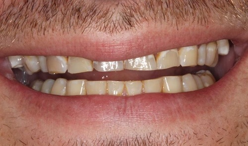 smile gallery image