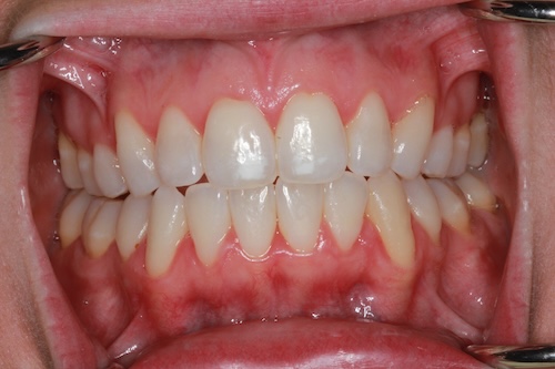 smile gallery image