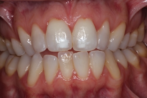 smile gallery image