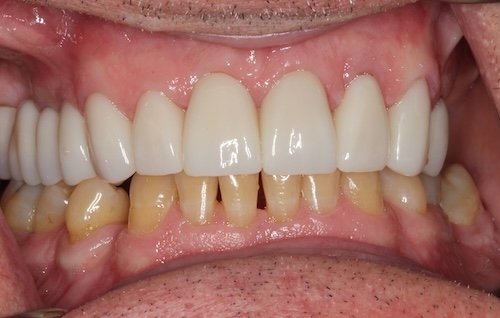 smile gallery image