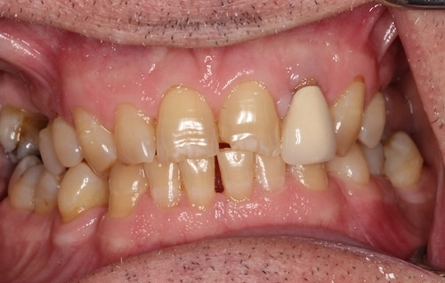 smile gallery image