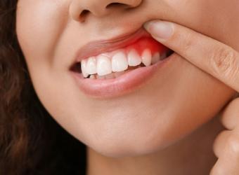 The Premier Choice For Periodontal Gum Treatment In Mesa, AZ - Dr. Shawn Monahan
